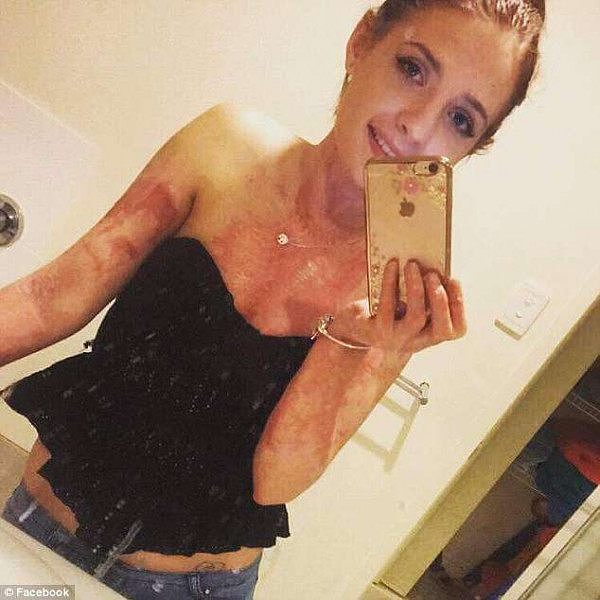 4CC5BC0800000578-5790365-Burns_covered_almost_her_entire_body_and_after_Lewis_pleaded_gui-a-6_1527759843873.jpg,0