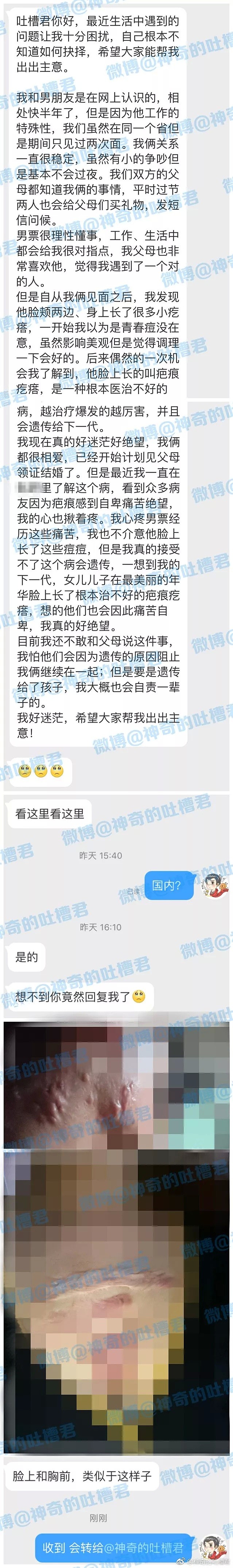 本以为男友脸上的疙瘩是痘痘，谁料他竟身患隐疾.... - 2