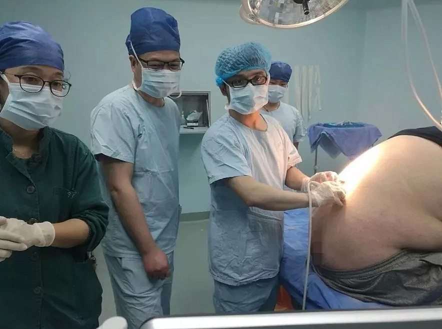 杭州27岁IT男，被这毛病折磨得度日如年！一推进手术室，惊呆医生！ - 1