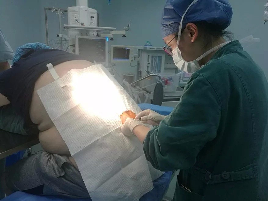 杭州27岁IT男，被这毛病折磨得度日如年！一推进手术室，惊呆医生！ - 2