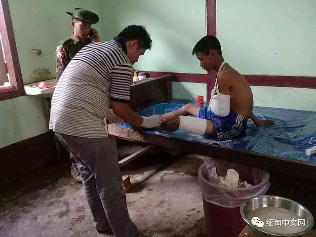 缅北16岁男孩踩地雷“被死亡”，丧事当天现身讲述7天痛苦经历！