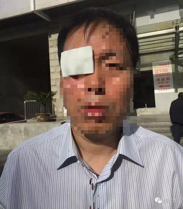 滴滴约车后被倒卖，乘客凌晨在东四环满脸是血，司机不知去向