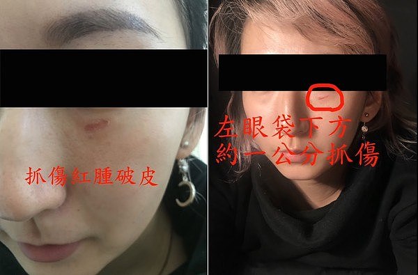 中国小哥来澳打工遭遇黑心华人工头！女同胞被暴打惨叫，“中国人丢自己的脸！”（视频/组图） - 4