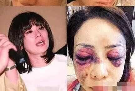 遭遇家暴的5位女明星：陈鲁豫被虐待，黄奕额头都凹下去了！