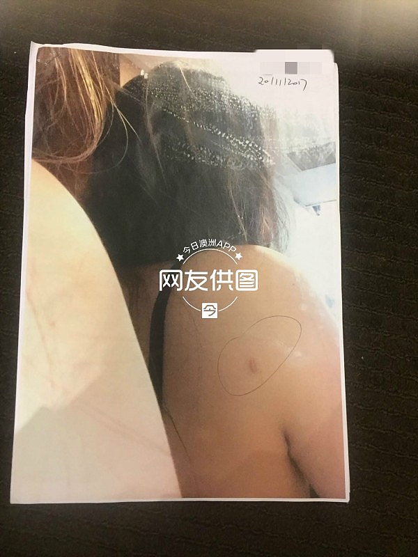 悉尼华女自曝被已婚男骗财骗色！“隐瞒婚史找小三小四”、“跟他爸爸一起按着我，浑身抓的紫烂青！”（组图） - 2