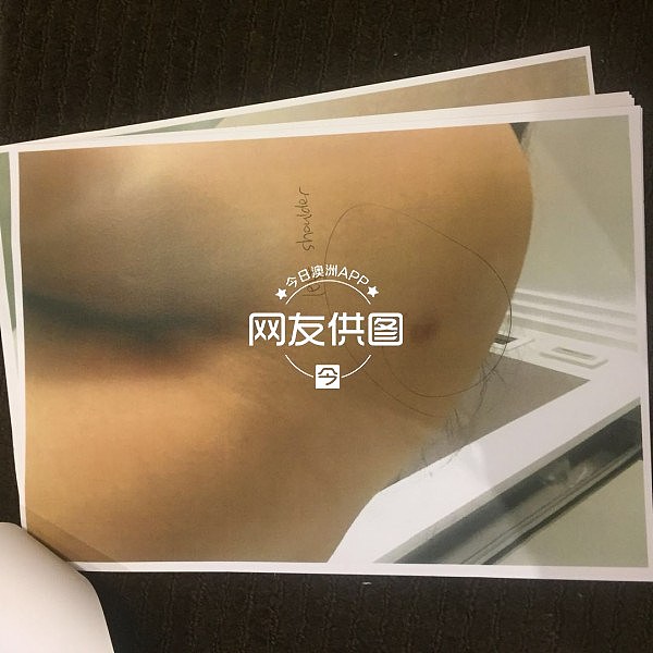 悉尼华女自曝被已婚男骗财骗色！“隐瞒婚史找小三小四”、“跟他爸爸一起按着我，浑身抓的紫烂青！”（组图） - 5