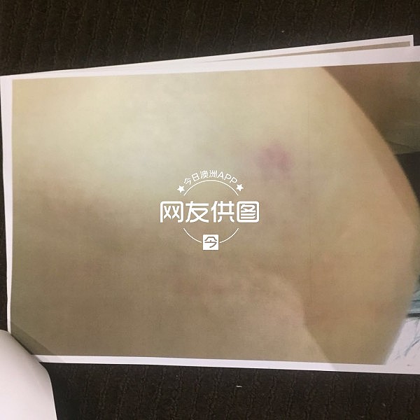 悉尼华女自曝被已婚男骗财骗色！“隐瞒婚史找小三小四”、“跟他爸爸一起按着我，浑身抓的紫烂青！”（组图） - 4