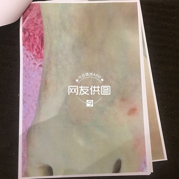 悉尼华女自曝被已婚男骗财骗色！“隐瞒婚史找小三小四”、“跟他爸爸一起按着我，浑身抓的紫烂青！”（组图） - 6