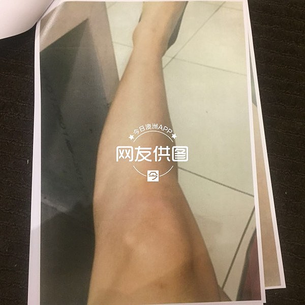 悉尼华女自曝被已婚男骗财骗色！“隐瞒婚史找小三小四”、“跟他爸爸一起按着我，浑身抓的紫烂青！”（组图） - 8