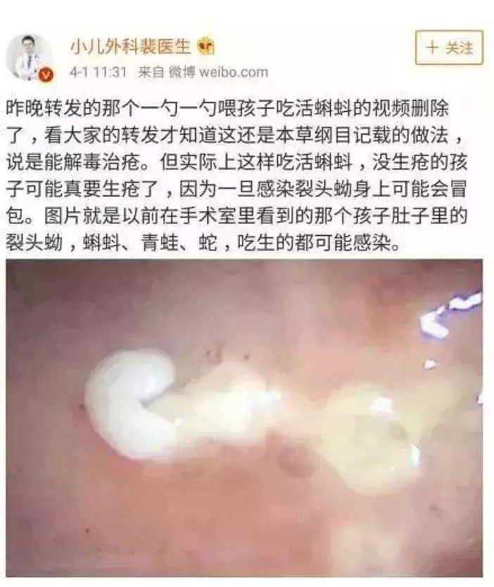 给三岁宝宝吃活蝌蚪、喝泥巴泡的水，这样的妈脑子有泡啊！（组图） - 6