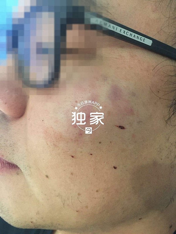 “他们叫嚣捅死我们、强奸我，还想烧店！”卧龙岗华人及留学生成袭击目标，频遭殴抢，多人受伤！（组图） - 3