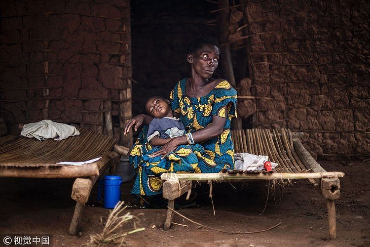 一位母亲和她感染了疟疾的孩子 / 视觉中国