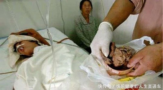 妻子下身疼痛3年, 医生为她做检查, 丈夫看完报告后气疯了（组图） - 3