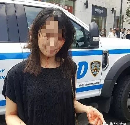 满脸是血，纽约街头华女遭受黑女群殴，警察却敷衍了事（组图） - 5