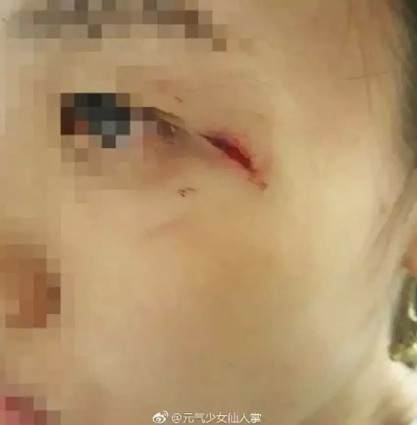 愤怒！中国女生遭3名黑人女子当街暴打，血流满面！全美华人圈都炸了（组图） - 3