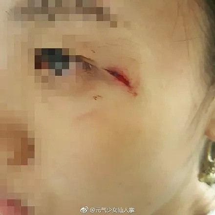 愤怒！中国女生遭3名黑人女子当街暴打，血流满面！全美华人圈都炸了（组图） - 7