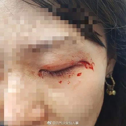 愤怒！中国女生遭3名黑人女子当街暴打，血流满面！全美华人圈都炸了（组图） - 8