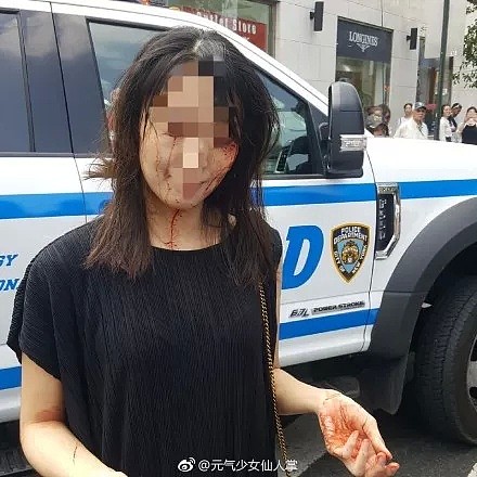 愤怒！中国女生遭3名黑人女子当街暴打，血流满面！全美华人圈都炸了（组图） - 9