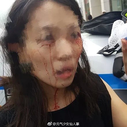 愤怒！中国女生遭3名黑人女子当街暴打，血流满面！全美华人圈都炸了（组图） - 10