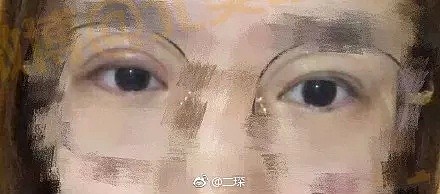 给大家看看，我们新开的欧式双眼皮...和单眼皮！ - 6