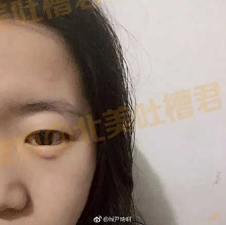 给大家看看，我们新开的欧式双眼皮...和单眼皮！ - 19