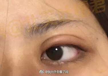 给大家看看，我们新开的欧式双眼皮...和单眼皮！ - 26