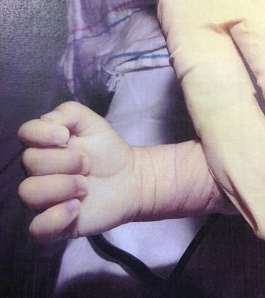 5个月大男婴被父母活活饿死，其父母则称孩子体格小（组图） - 2