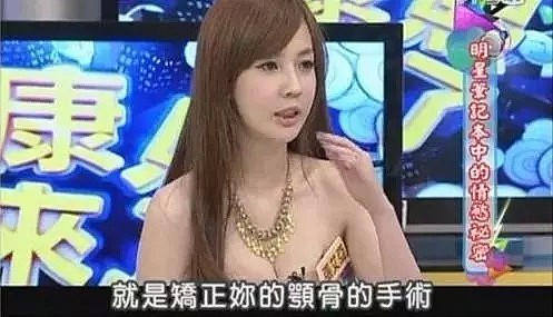 女星全裸照流出，原来她悄悄出轨一年，还整容到口水失禁？（组图） - 4