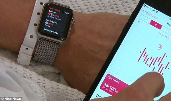 悉尼小哥睡觉时，Apple Watch突然发出一个通知，最后竟救了他一命！“没有它我就死了”（组图） - 3