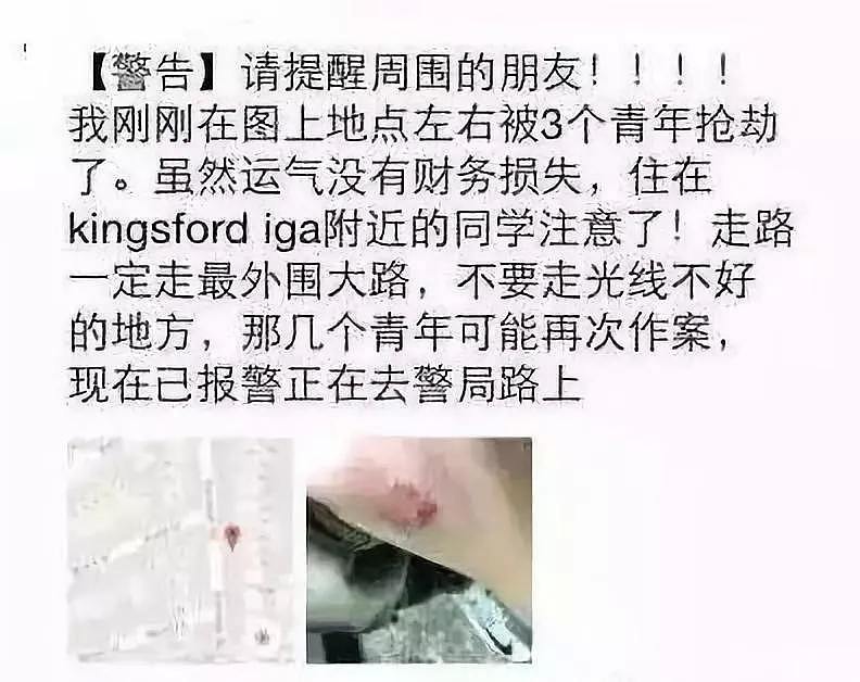 警惕！悉大中国留学生在华人区遇袭被抢，手臂负伤！独行女留学生或成目标（组图） - 9