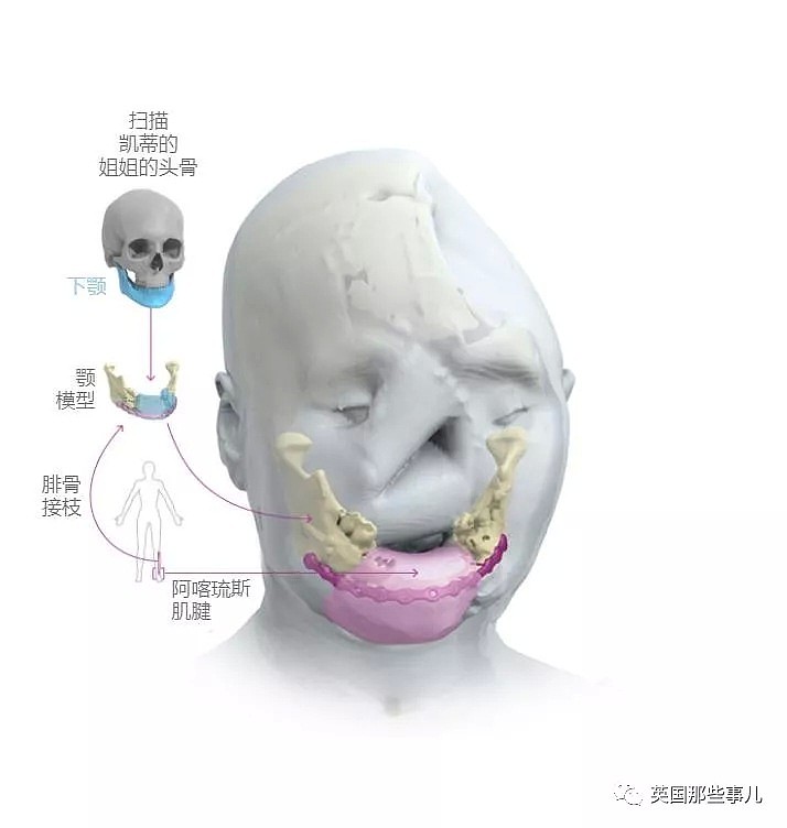 今年21岁的她，一生却有过3张面孔。而故事的意义，却不只是换脸那么简单（组图） - 8