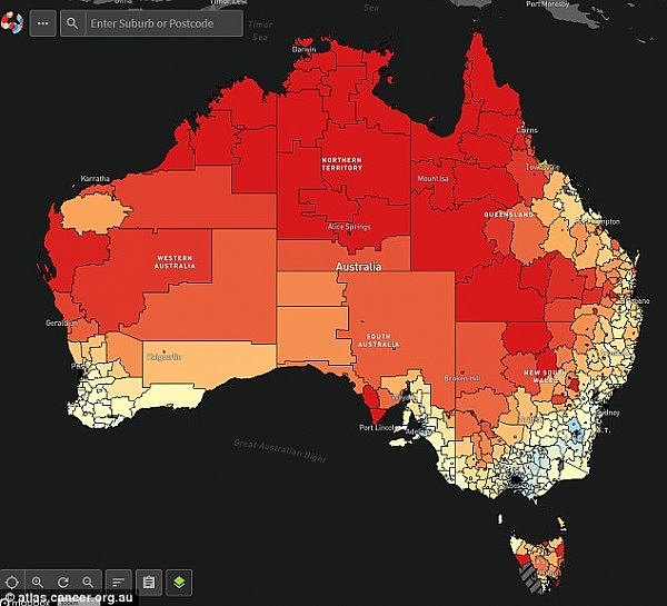 震惊！澳洲最新“癌症地图”出炉！6大癌症在这些地方最普遍！你的城市上榜了吗？（组图） - 3