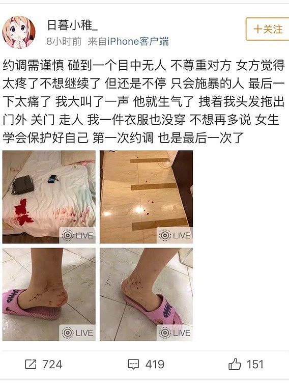 中国羽坛名将被曝涉SM丑闻，女生下体出血被全裸赶出门外，惊悚照片曝光（组图） - 1
