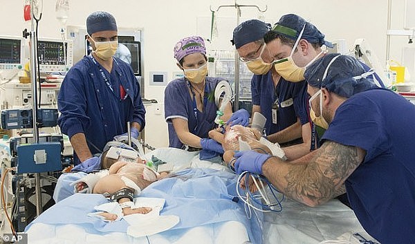 给澳洲医生点赞！亚洲连体女婴成功接受分离手术（组图/视频） - 3