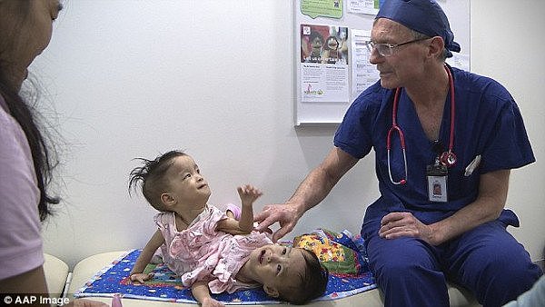 给澳洲医生点赞！亚洲连体女婴成功接受分离手术（组图/视频） - 4
