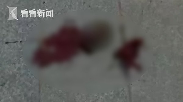 18岁女孩两脚一开喷10cm血块！B超一看是胎儿流产！傻眼：以为月经（组图） - 2