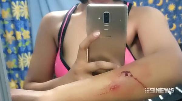 亚裔女子在悉尼街头遭teenager持刀抢劫，全身多处被划伤！（组图） - 2