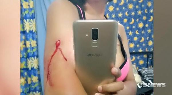 亚裔女子在悉尼街头遭teenager持刀抢劫，全身多处被划伤！（组图） - 3