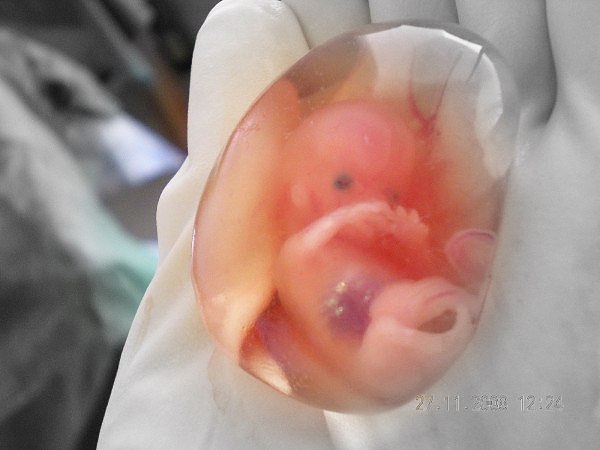 Human_fetus_10_weeks_-_therapeutic_abortion.jpg,0