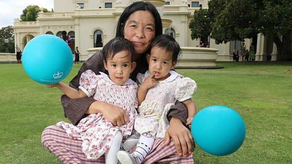 不丹连体婴儿澳洲接受分离手术后恢复良好 将返回祖国（图） - 2