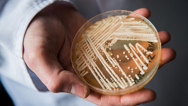 “超级病菌”已入侵澳洲！至今无药可医，成因仍然是个谜！（组图） - 1