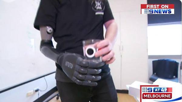澳洲一男子仅凭意念就能控制假肢，肢体仿生技术为截肢患者带来了福音（组图） - 2