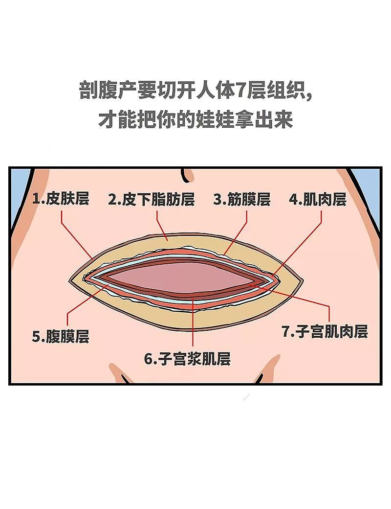 【健康】关于生孩子这件事，女人有多不容易？（组图） - 17