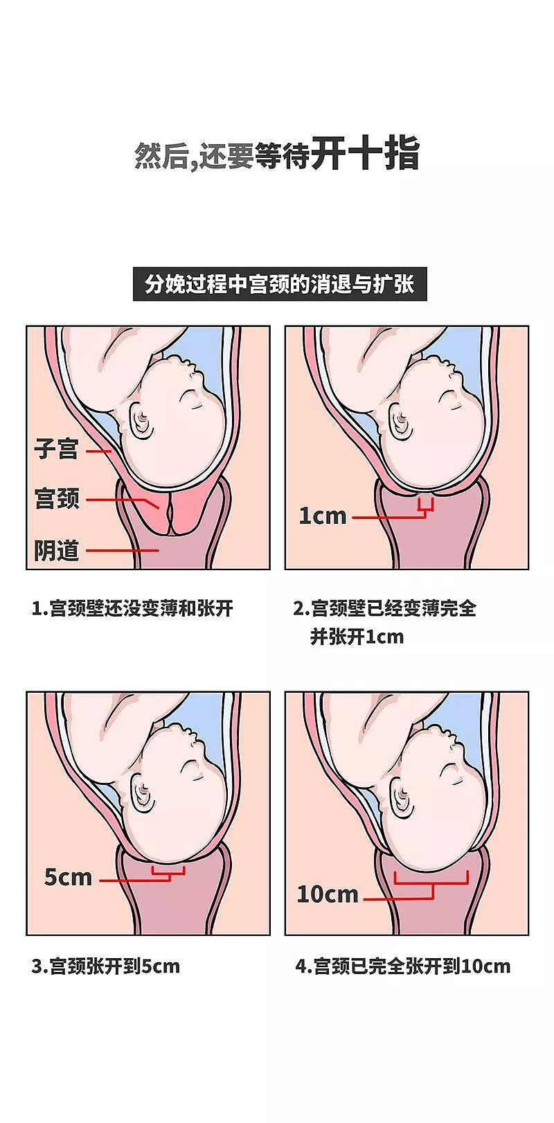 【健康】关于生孩子这件事，女人有多不容易？（组图） - 12