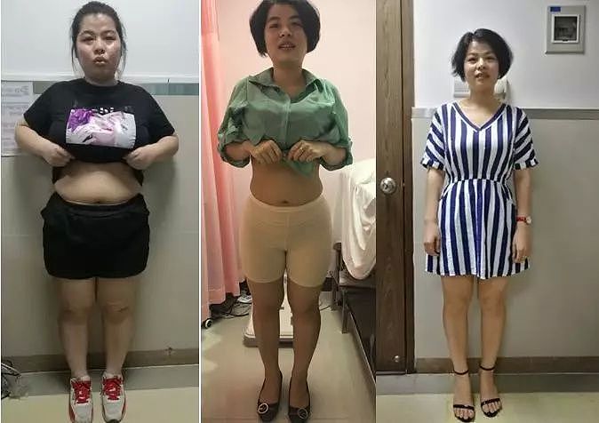 170斤姑娘减肥，医生却让她多吃肉！一年狂瘦55斤（组图） - 1