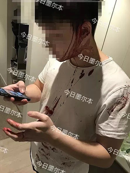 疑因女友跟了别人，墨尔本华男挥锤行凶，一打四敲裂同胞头骨致血流满面！（组图） - 1