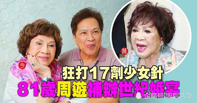 80岁的台湾女星为了与老公复婚，花60万打17针玻尿酸恢复青春（组图） - 3