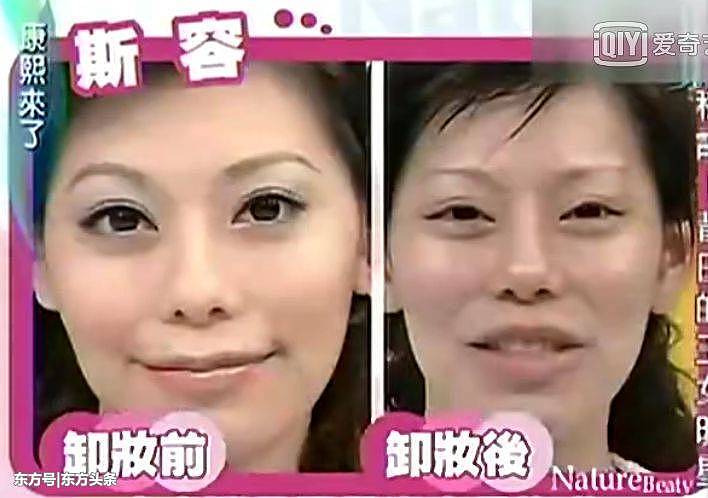 41岁女主持整容60多次，结果上半脸像猴子，下半脸像青蛙……（组图） - 3