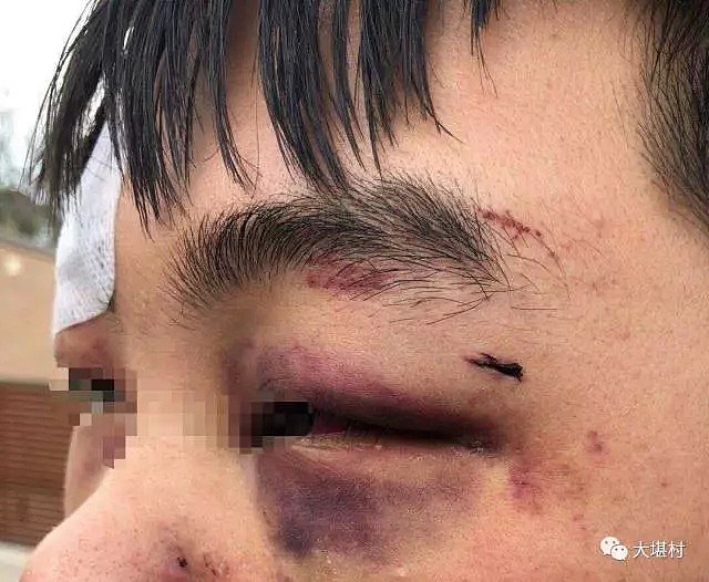 又有在澳中国留学生被围堵，殴打洗劫！当地teens频频伤人，学生曾被打到满脸是血！（组图） - 16