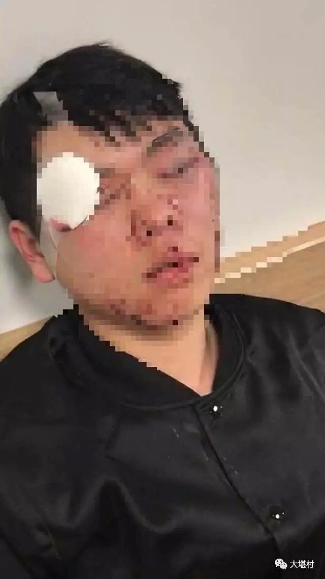 又有在澳中国留学生被围堵，殴打洗劫！当地teens频频伤人，学生曾被打到满脸是血！（组图） - 17